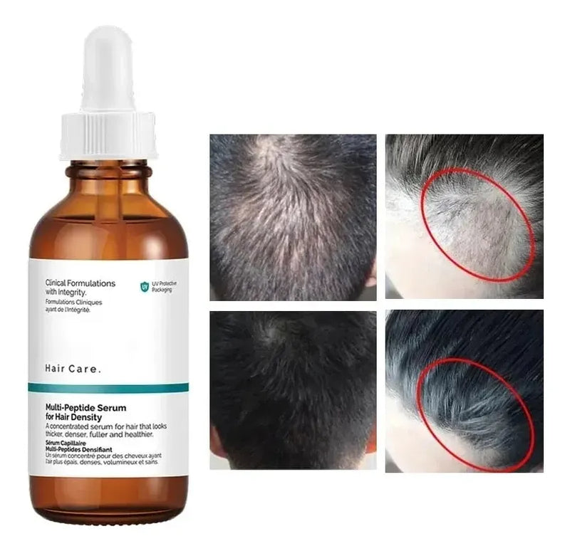 Suero the ordinary multipeptido