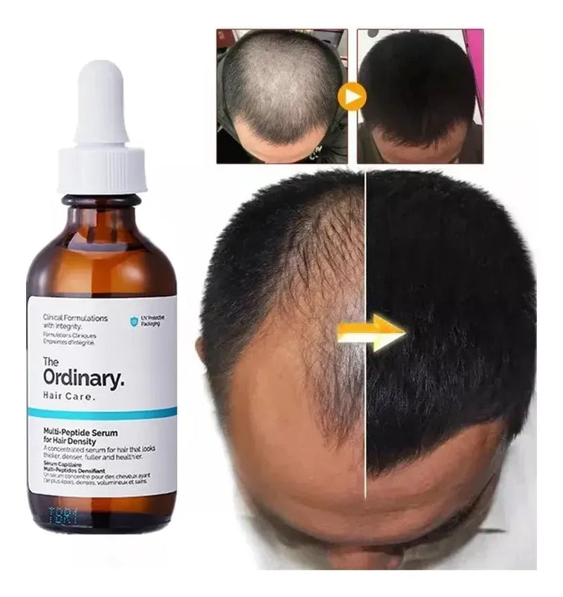 Suero the ordinary multipeptido